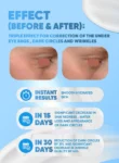 GLAMYLABBeautifyingEyeContourFiller_1